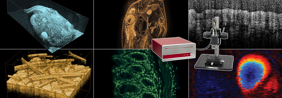 OCT Measures Capillary Blood Flow