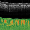 Tissue Birefringence