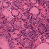 OCM image of thyroid