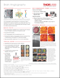 OCT Angiography